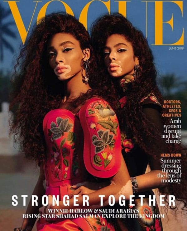 СЪВЕТИТЕ ЗА КРАСИВ ВЪНШЕН ВИД НА УИНИ ХАРЛОУ