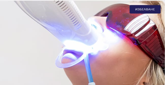 домашно избелване на зъбите