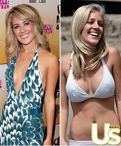 Подарък „Нови гърди” е сред най-актуалните и широкоразпространени мании по света