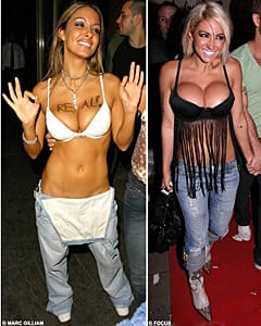 Подарък „Нови гърди” е сред най-актуалните и широкоразпространени мании по света